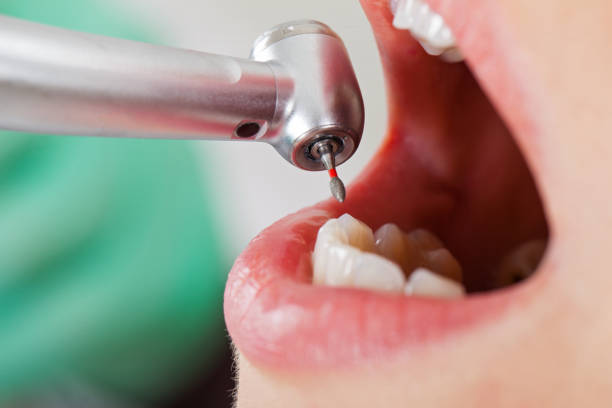 Best Emergency Treatment for Toothache in Lantana, FL